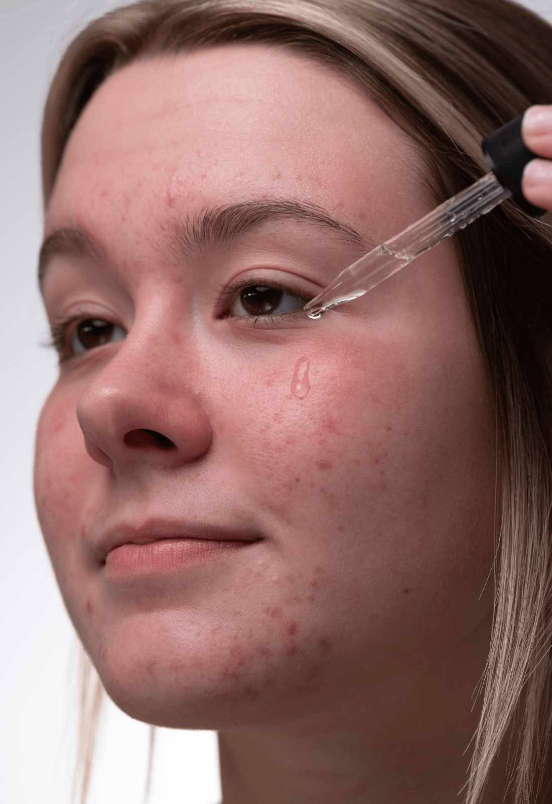 Salicylic Acid 02%